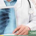 tudoszurok