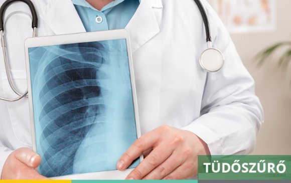 tudoszurok